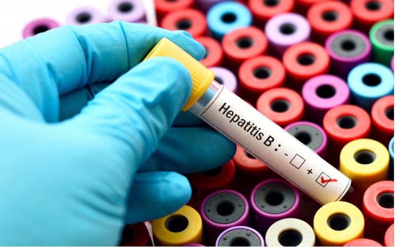 HEPATITIS MARKERS